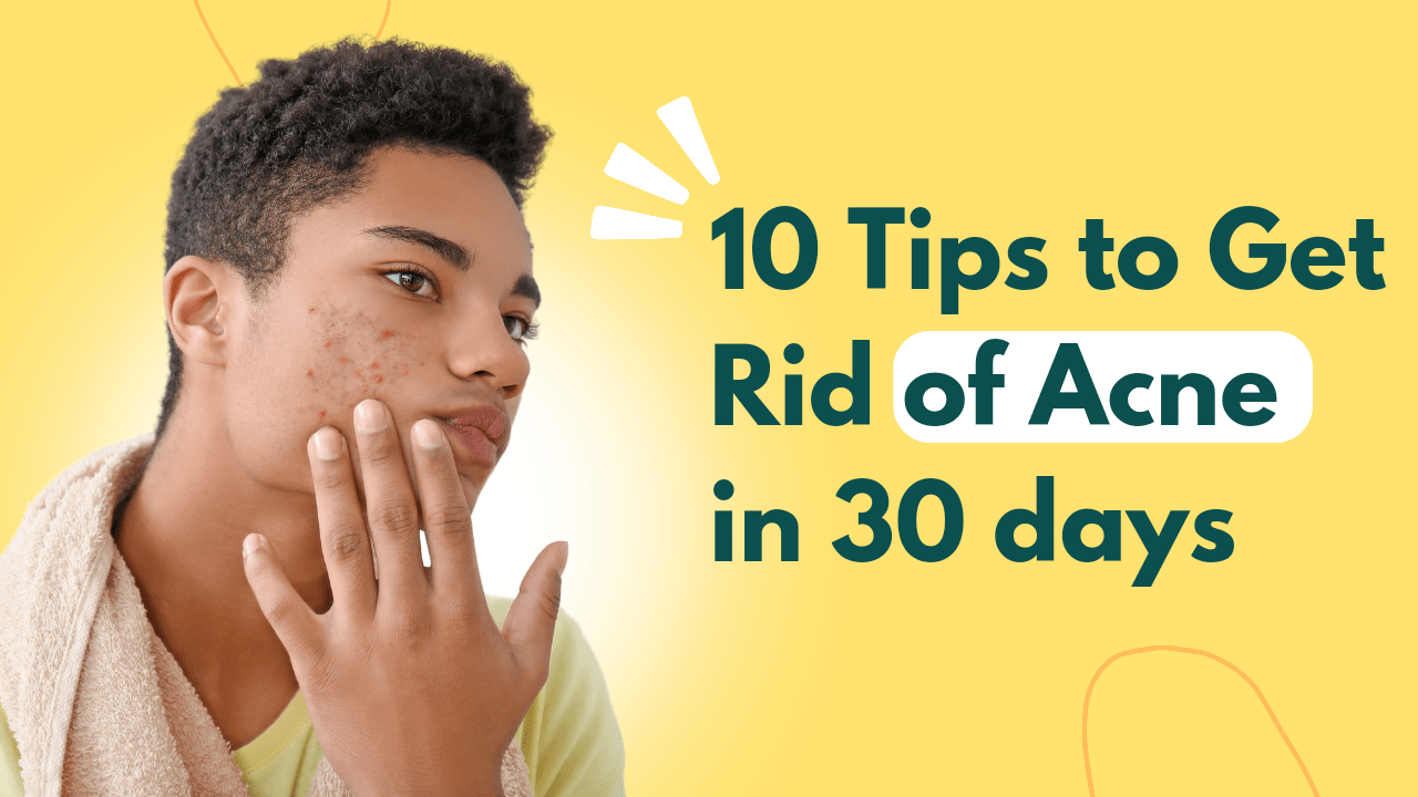 10 tips to get rid of Acne